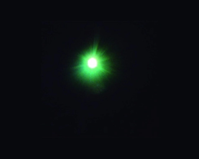 Retinoblastoma
